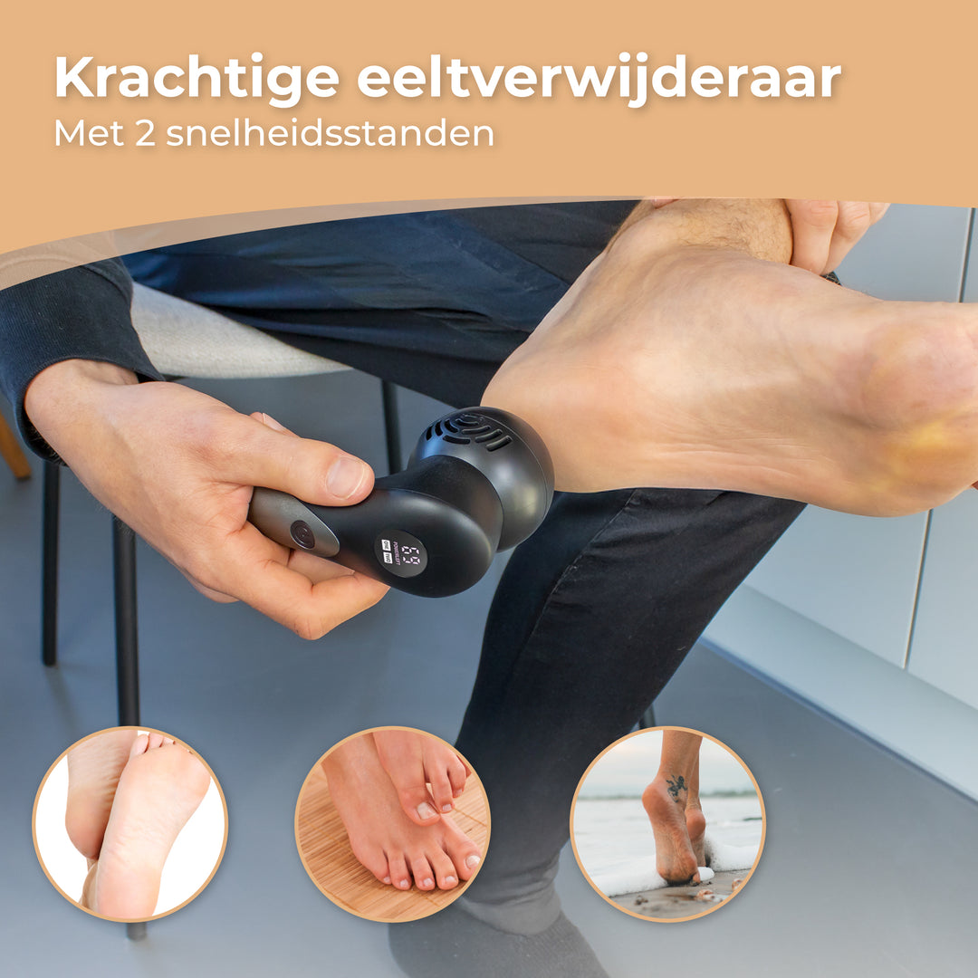 Elektrische Eeltverwijderaar